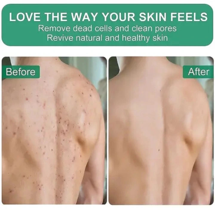 Exfoliating Glove